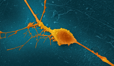 une-remyelinisation-corticale-precoce-a-un-effet-neuroprotecteur-dans-la-sclerose-en-plaques-830x483.png